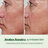 Centalla Face Cream